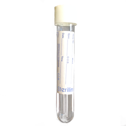 Albumin (Urine) (microalbumin ACR)