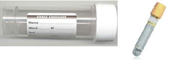 CSF Isoelectric focusing for oligoclonal bands