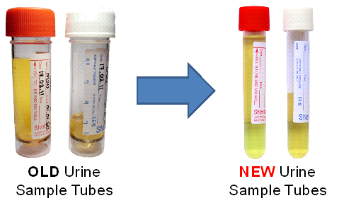 Urines for M,C&S – Change of Sample Tubes